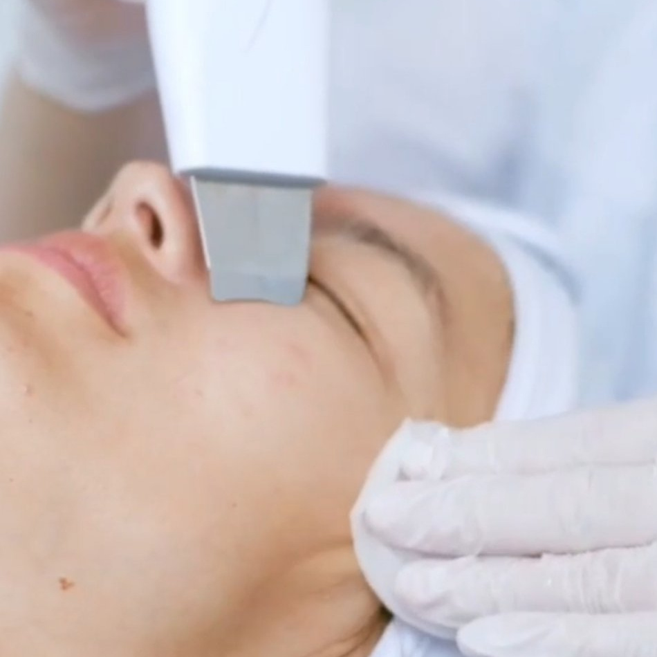 УЗ - чистка (пилинг)