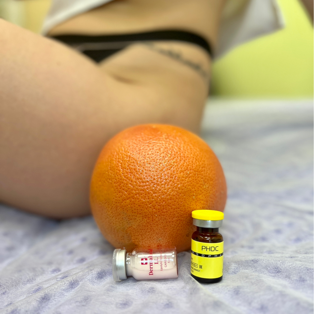 Липолитики