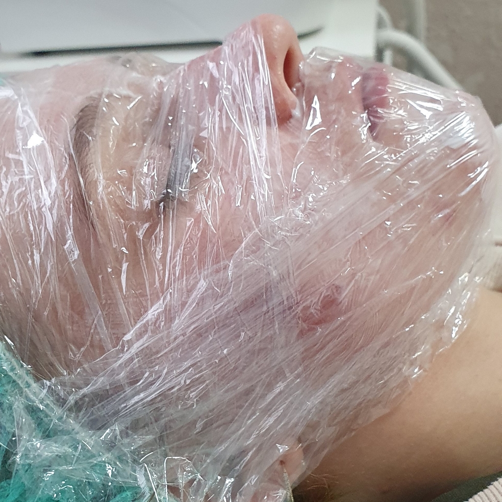 Чистки и пилинги