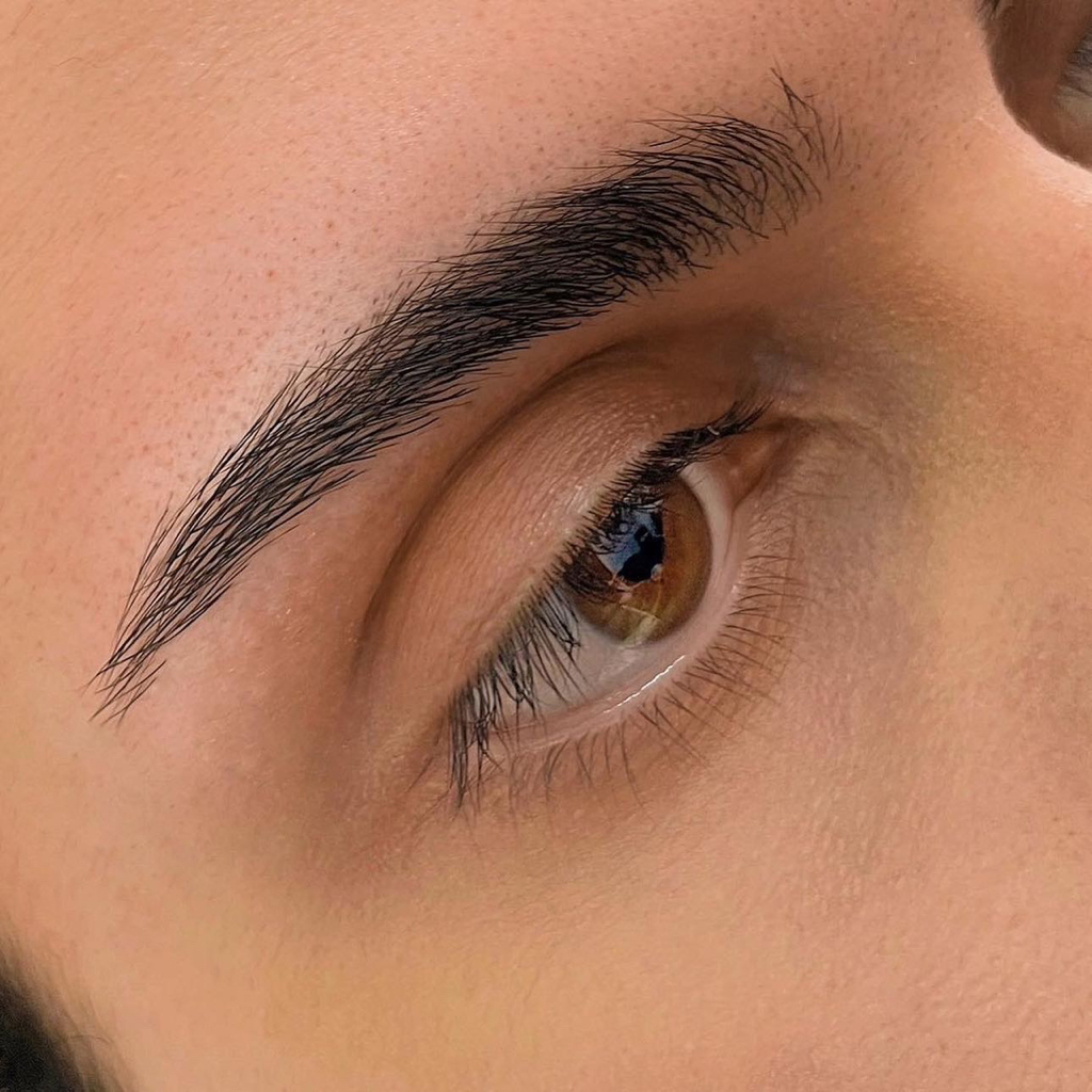 Brow correction