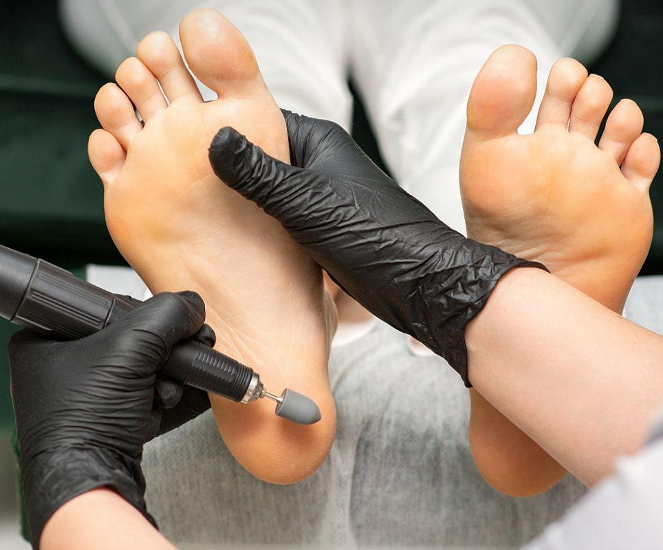 Мужской педикюр