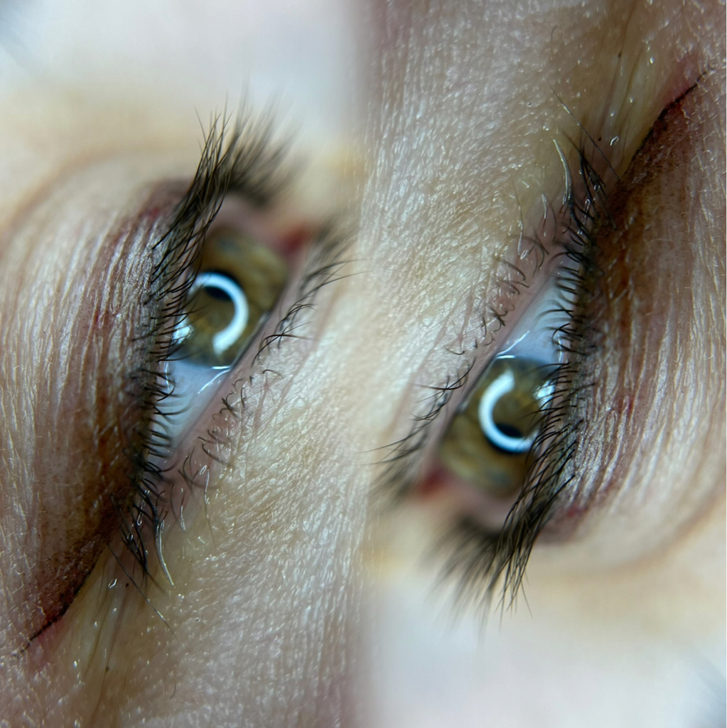 Консультация