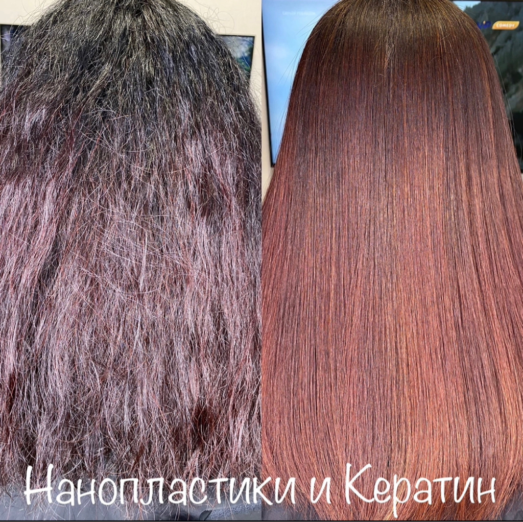 Нанопластика и Кератин