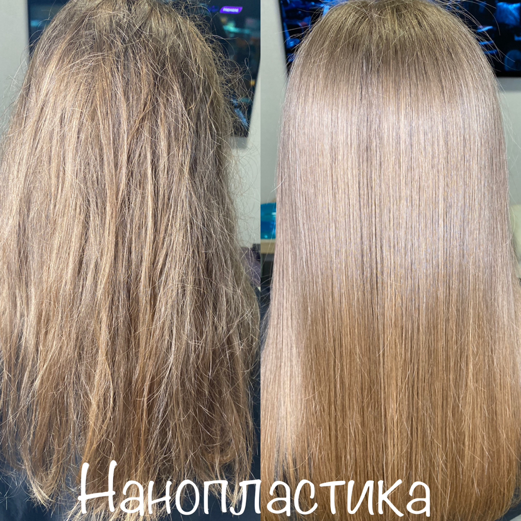 Нанопластика (волосы до плеч)