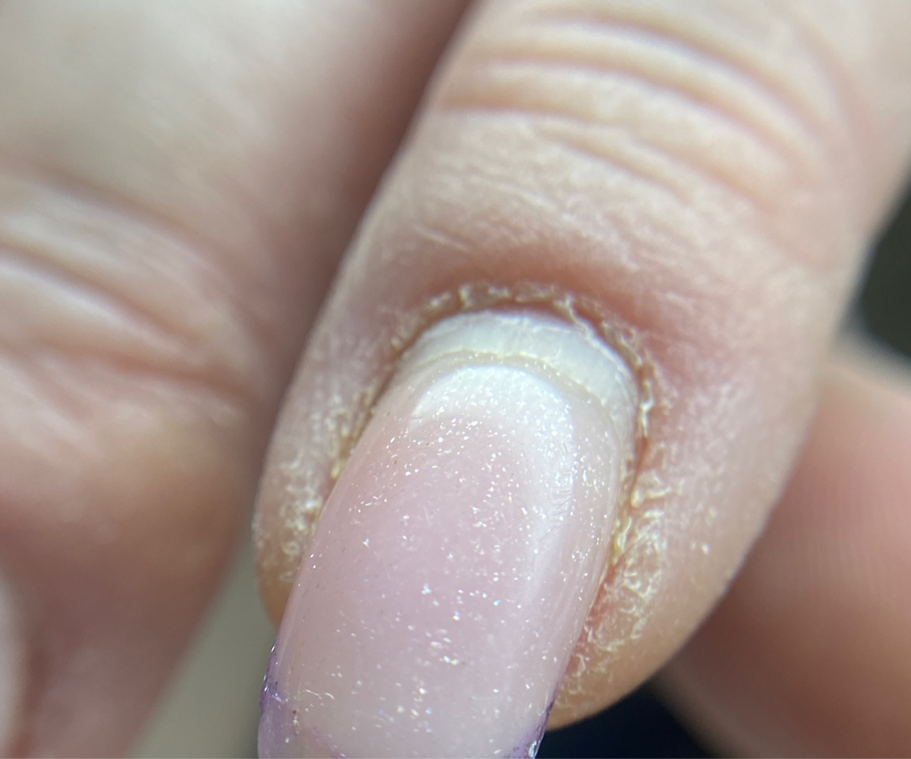 Коррекция наращенных ногтей