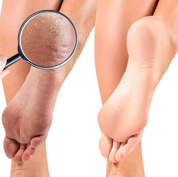 Педикюр стопы