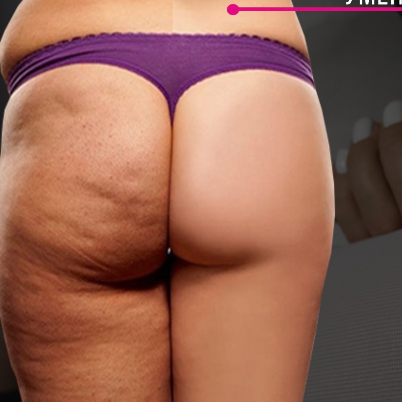 LPG-массаж по маслу