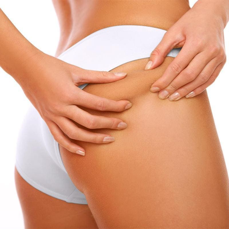 «FACTURA  МИНИ» АНТИЦЕЛЮЛЛИТНАЯ ПРОГРАММА