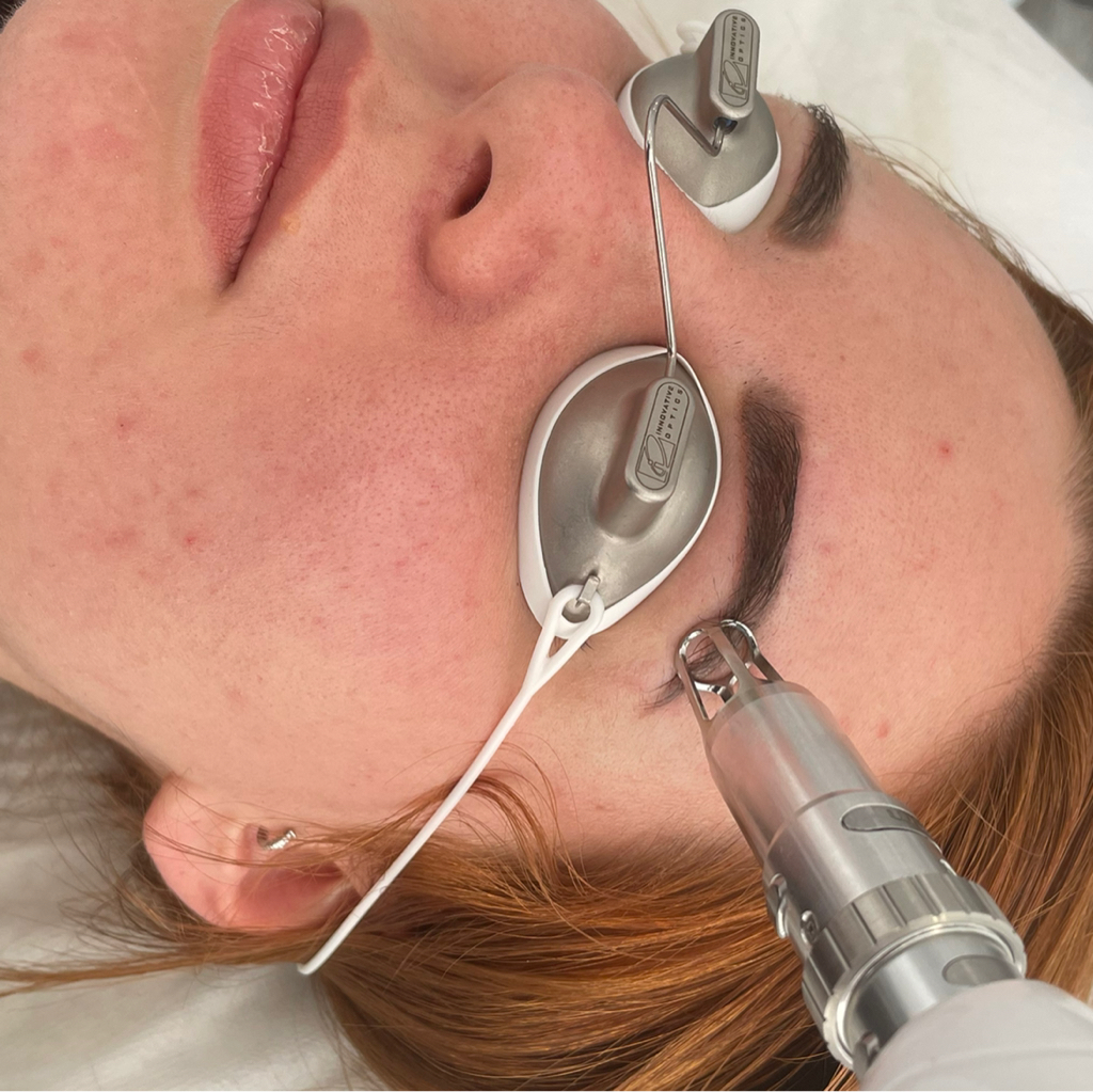 Permanent make-up removal