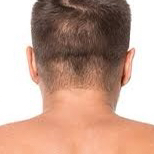 Hairline Back Men HR