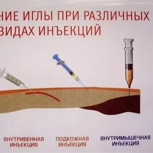 Биоревитализация лица  препаратом Mesopharm Hydra Line