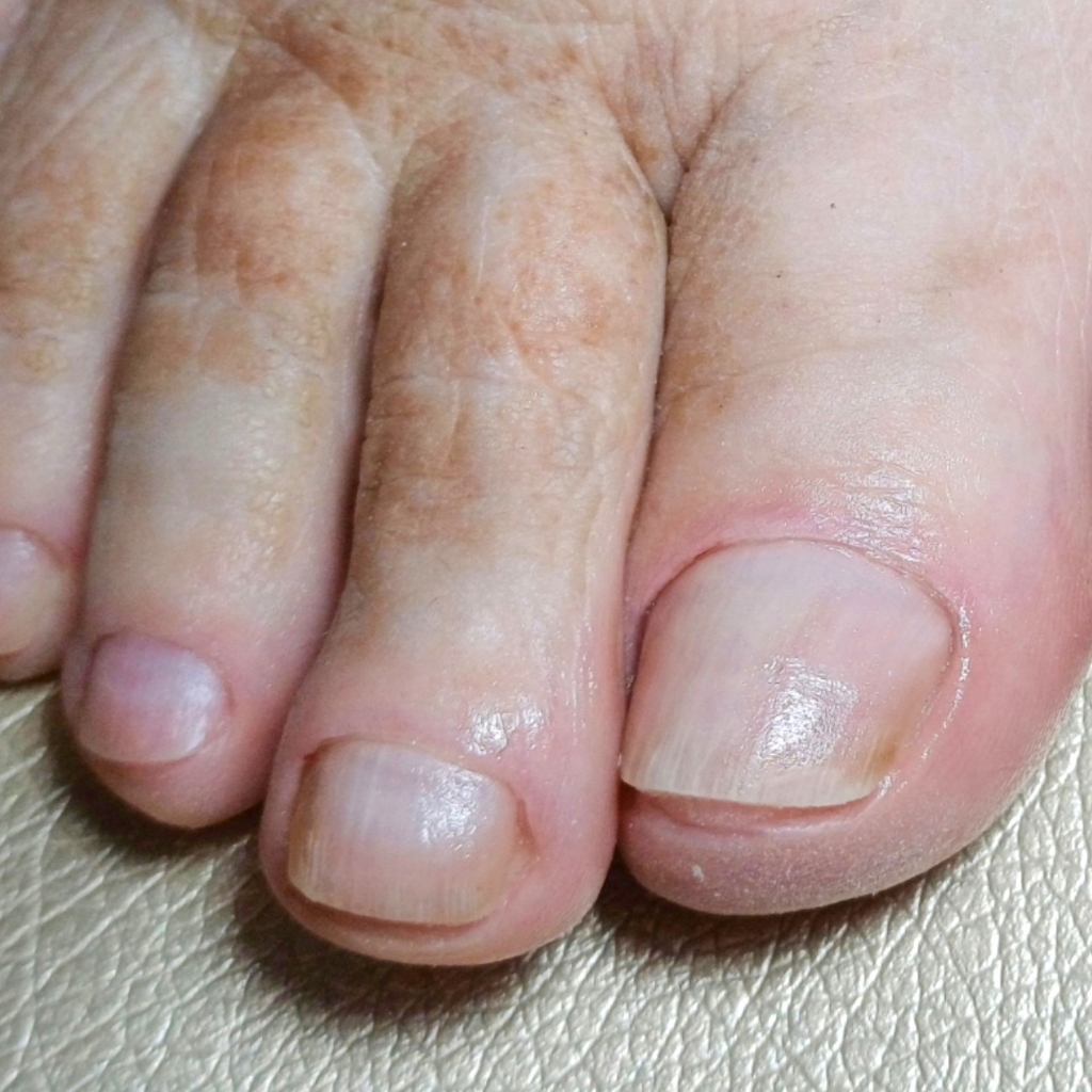 Только пальчики без покрытия