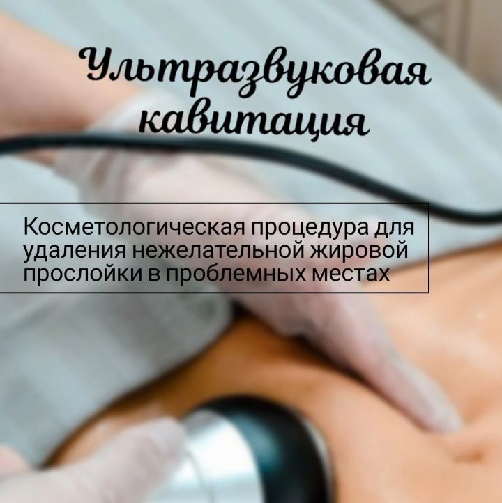 Кавитация
