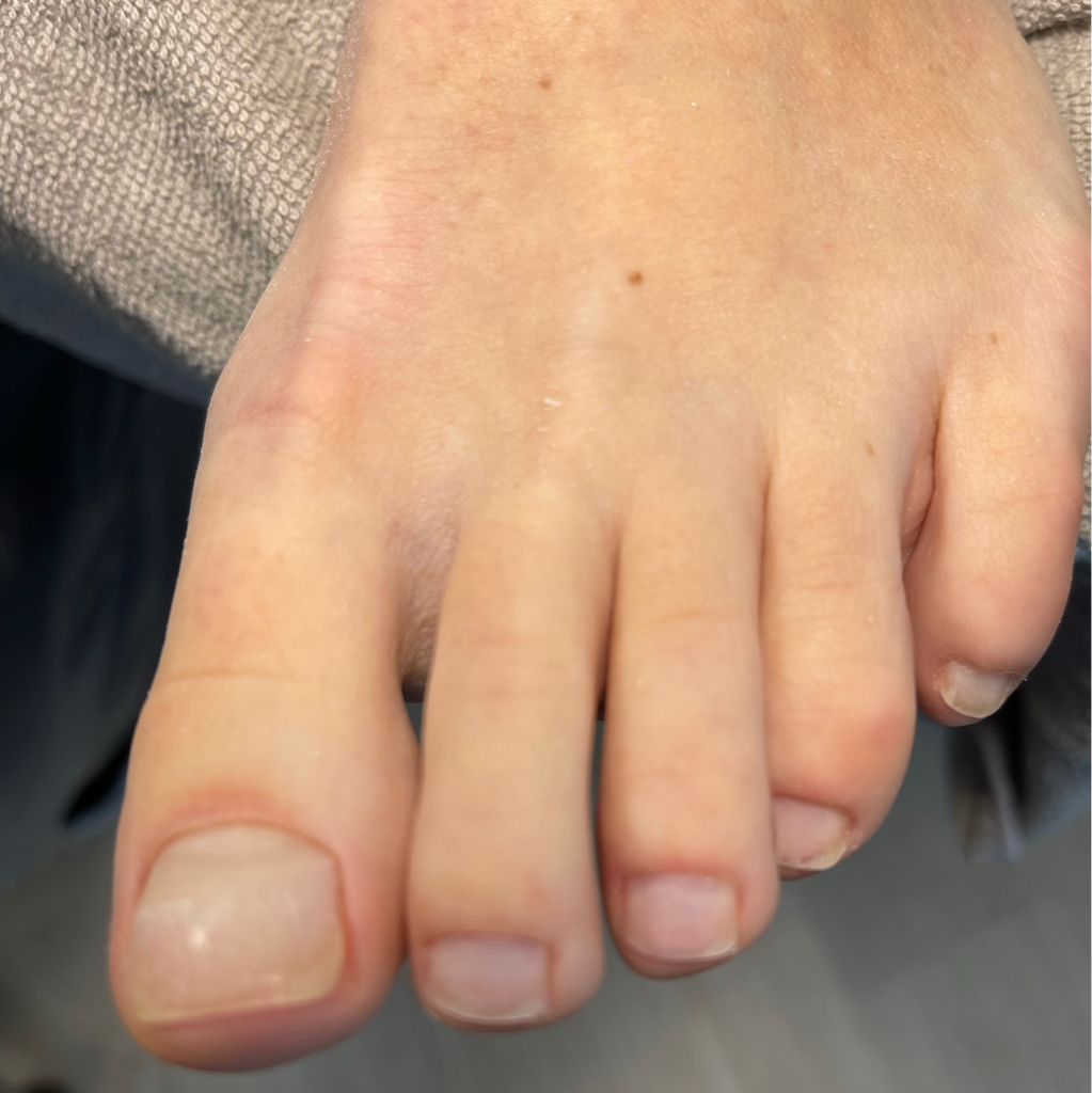 Аппаратный педикюр без покрытия.