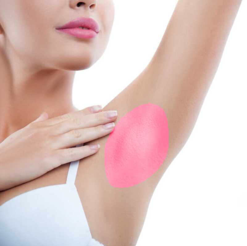 Лазерная эпиляция «Подмышечные впадины»