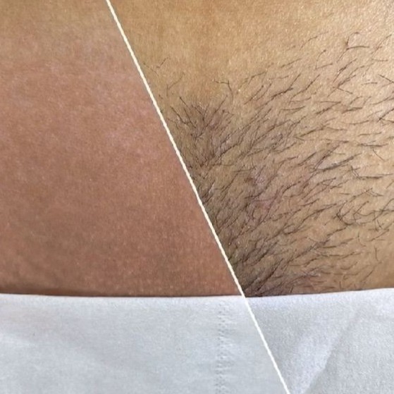 Бикини глубокое