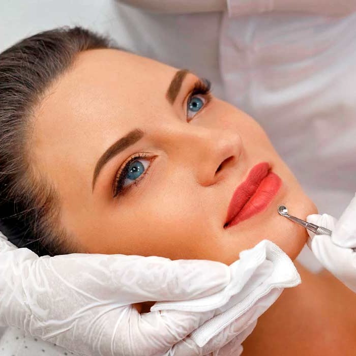 Механич. чистка 1 степень акне+криомассаж