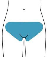 Уход за кожей зоны бикини