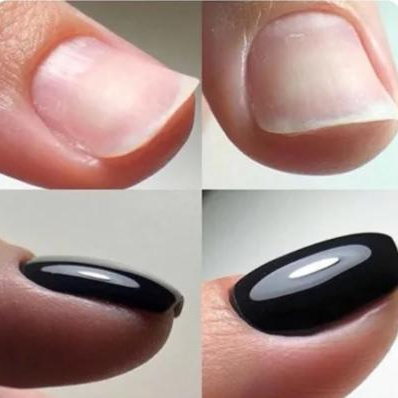 Выравнивание ногтевой пластины