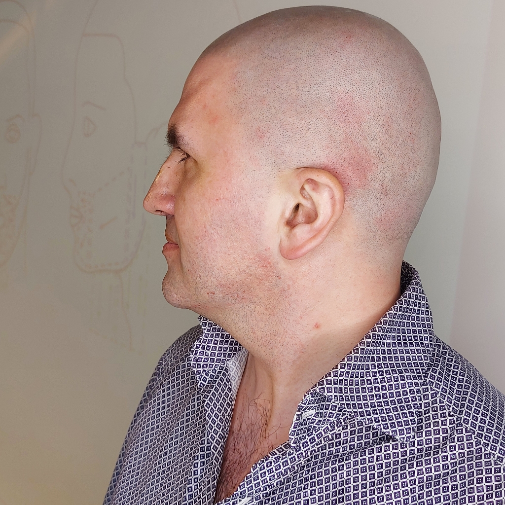 Наголо (Стрижка машинкой, мытье).