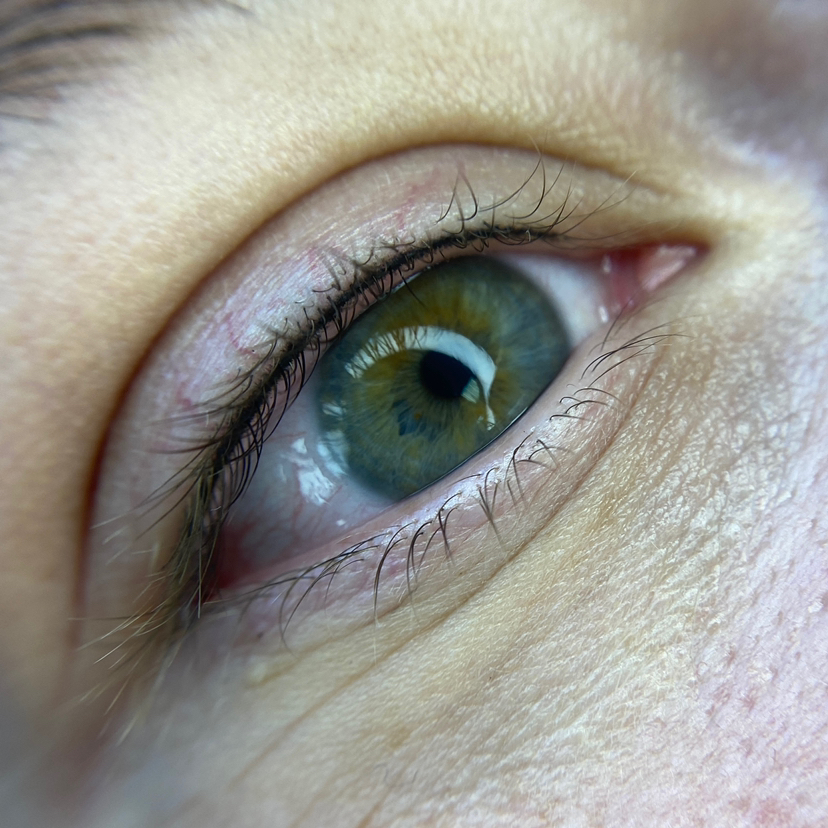 Первичная процедура ПМ Межресничка