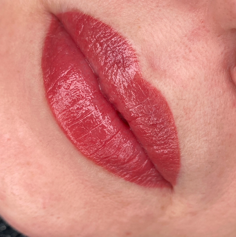 Первичная процедура ПМ Губы