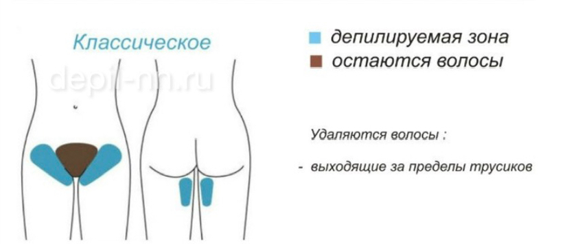 Бикини классика шугаринг