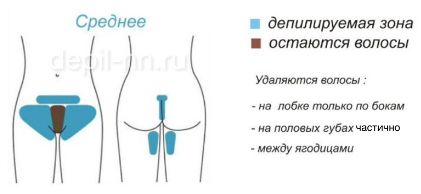 Бикини среднее шугаринг