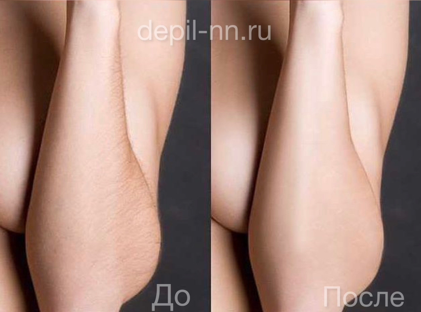 Руки полностью шугаринг