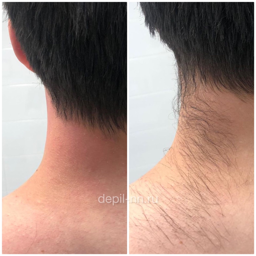 Окантовка стрижки плёночным воском для мужчин