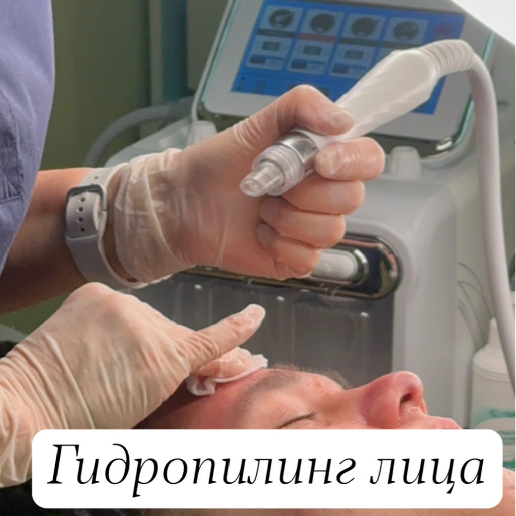 Гидропилинг лица
