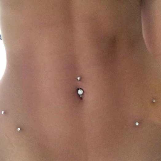 Снятие /чистка микродермала