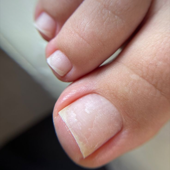 гигиенический педикюр обработка пальцев и стоп (без снятия и покрытия)