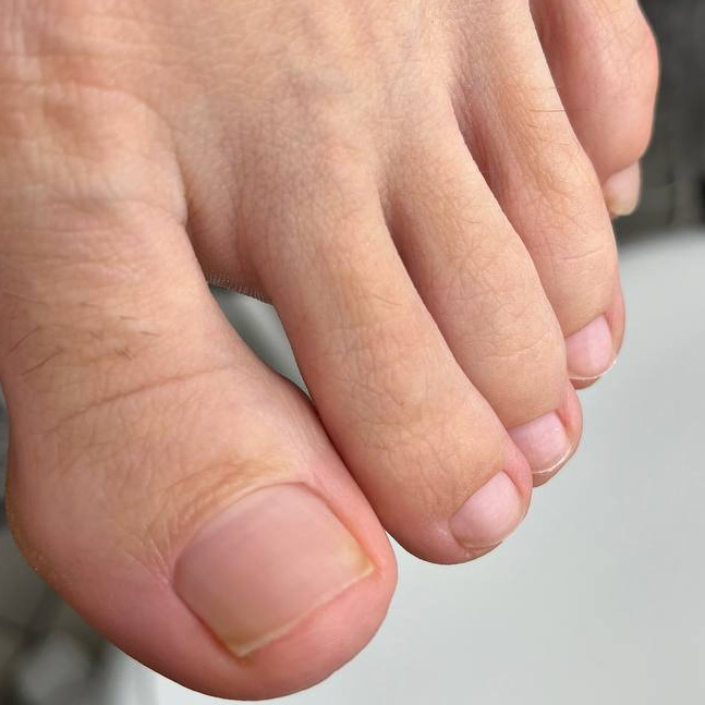 Обработка ногтей на ногах без покрытия Подолог