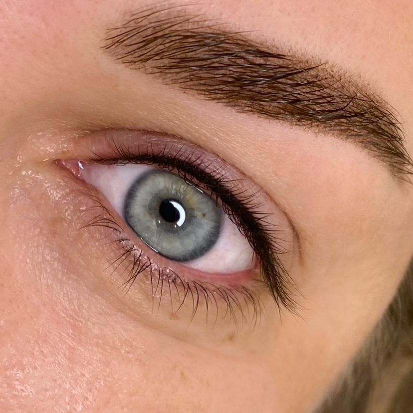 Межресничка