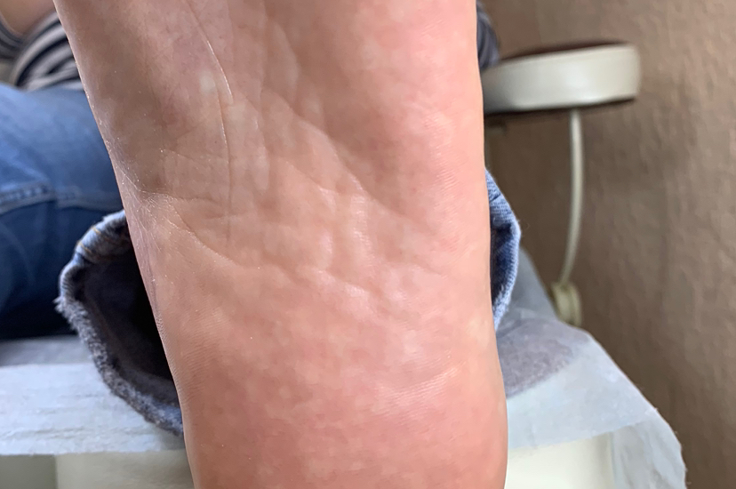 Smart-педикюр