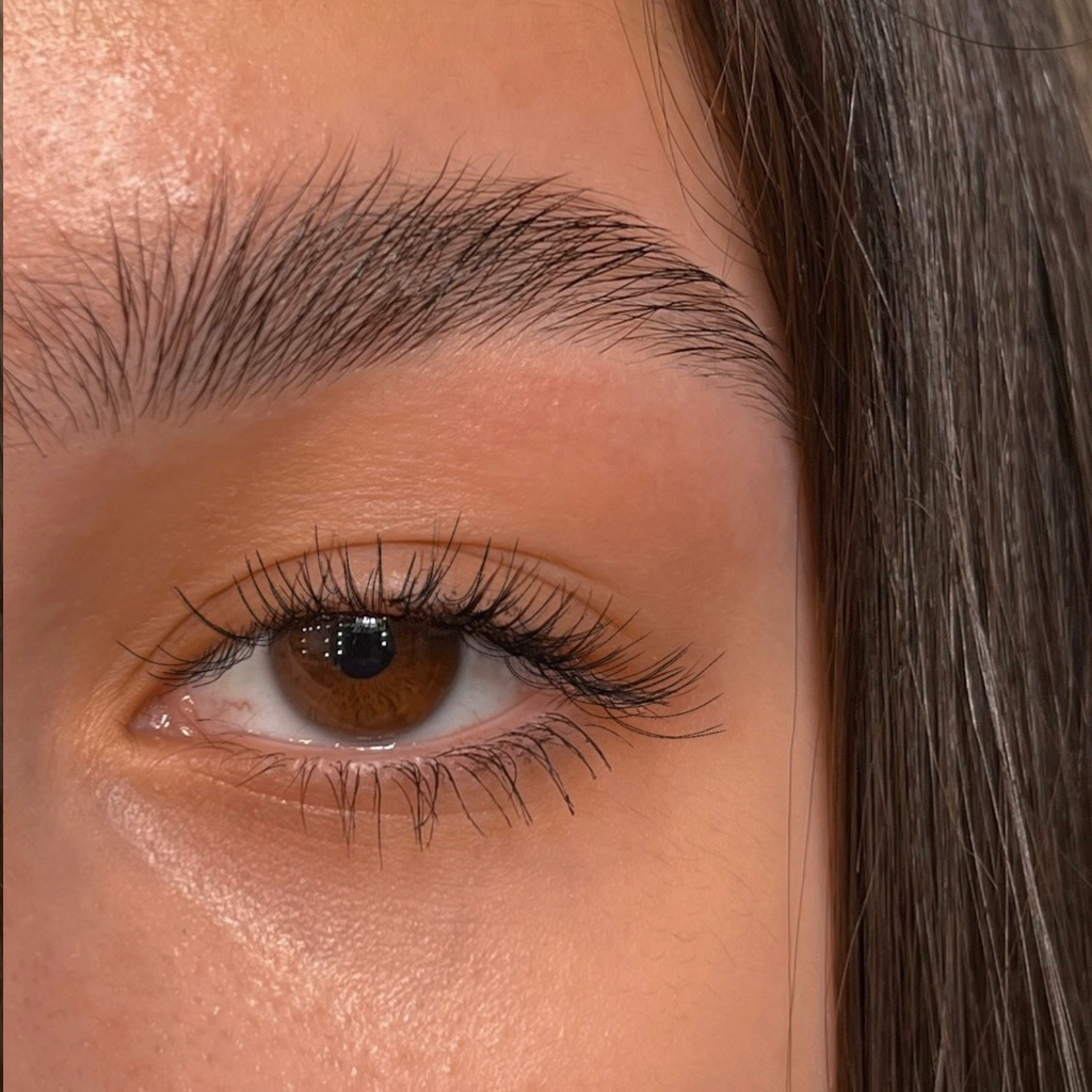 Прореживание / структурная коррекция