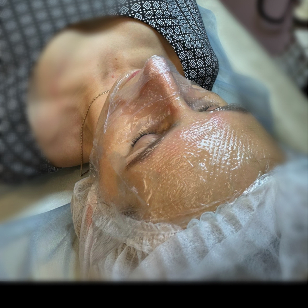 Механическая чистка лица