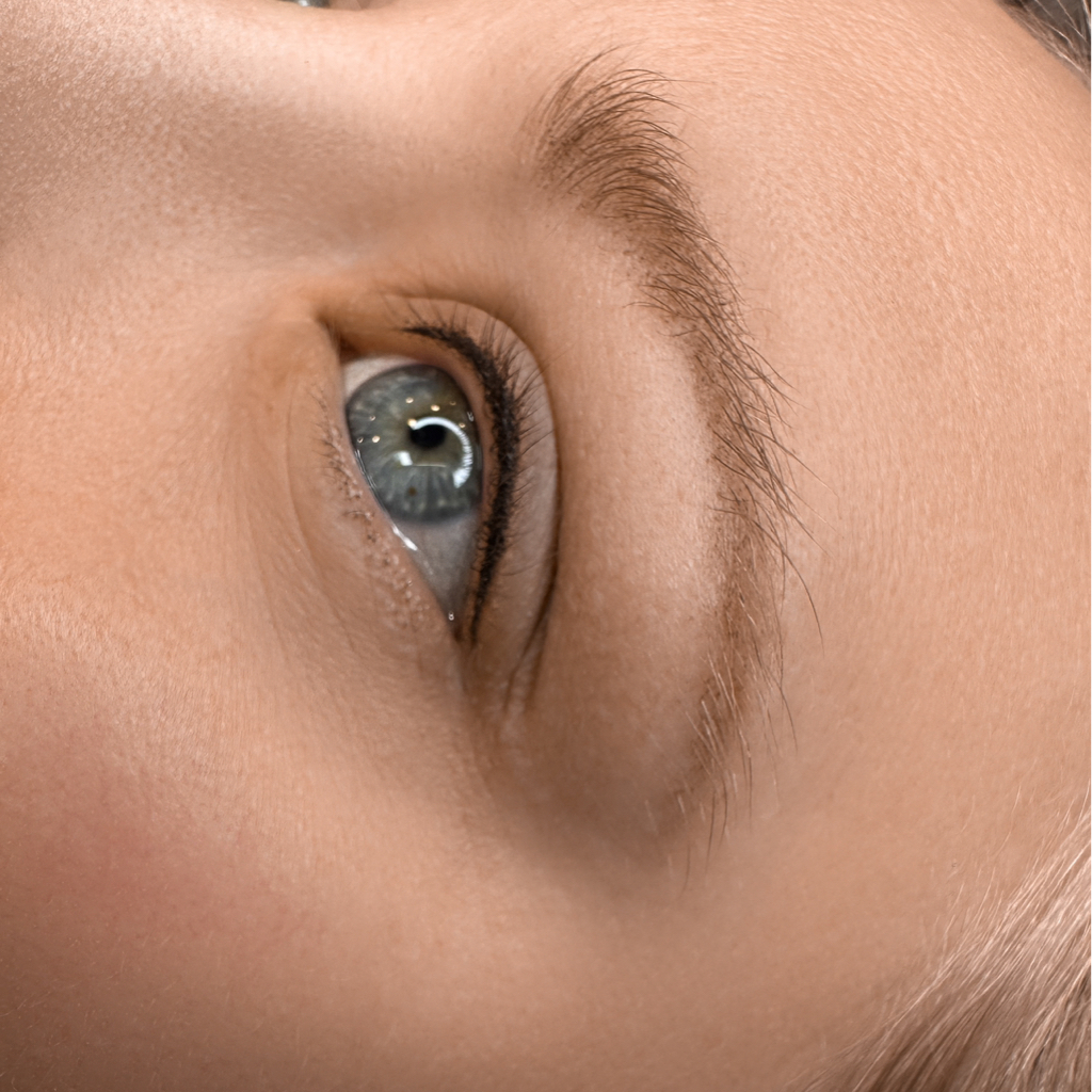 Межресничка