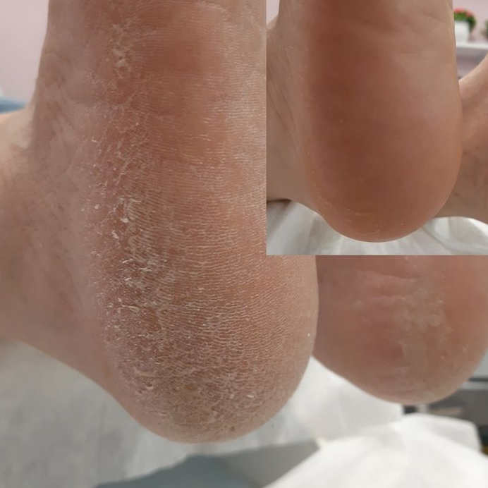 Педикюр: обработка стопы и пальцев без покрытия. Категория "Мастер" (снятие чужой работы +350р.)