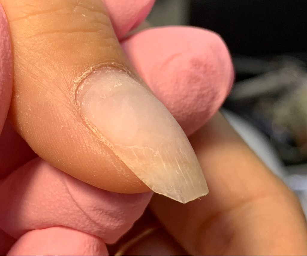 Ремонт одного ногтя