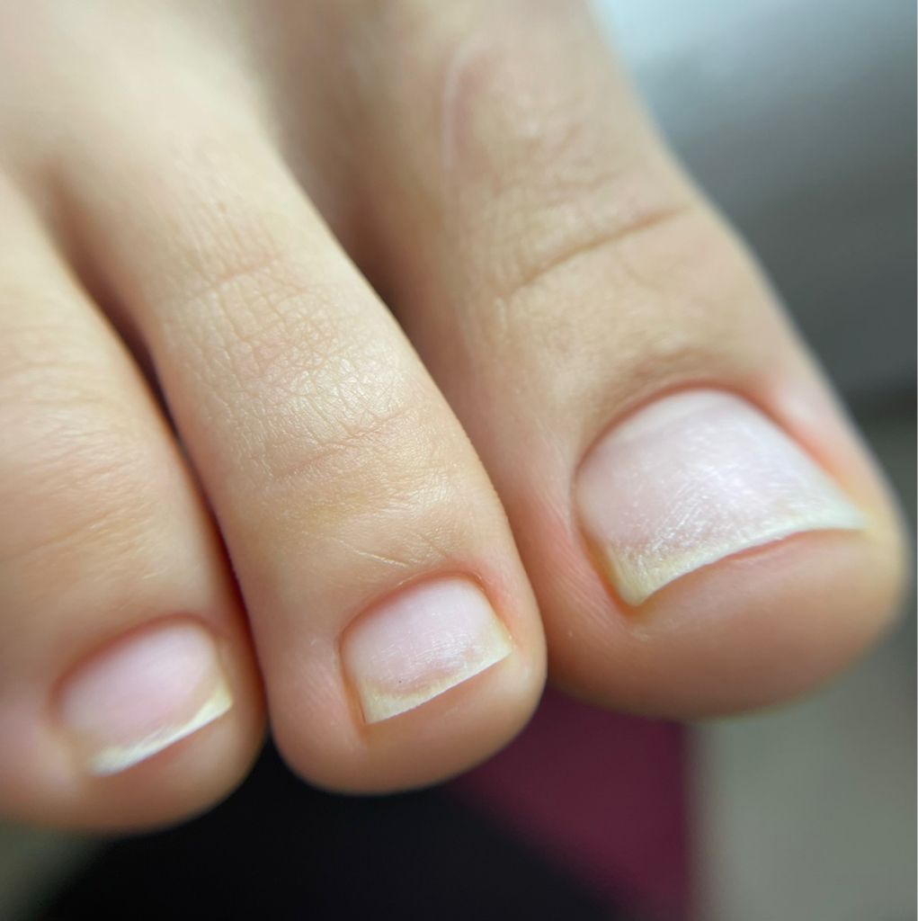 Гигиенический педикюр(пальчики + стопа)