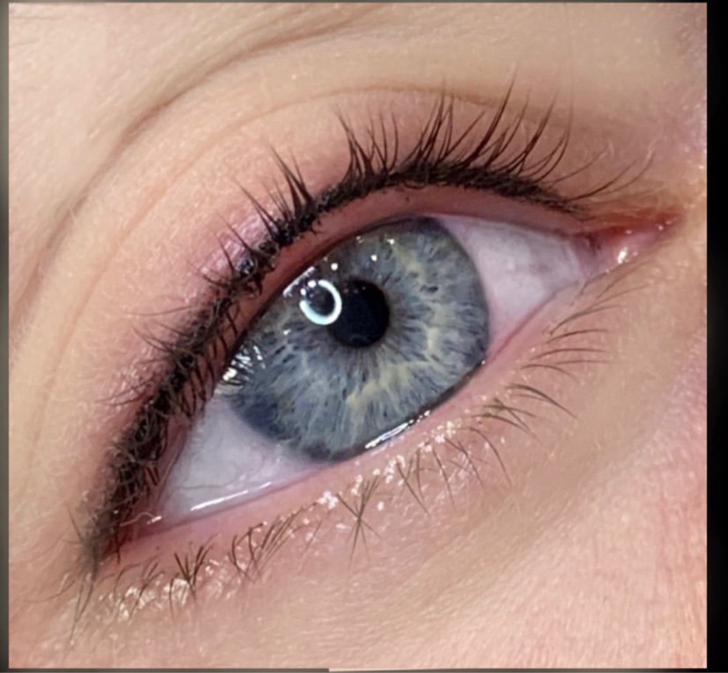 Межресничка