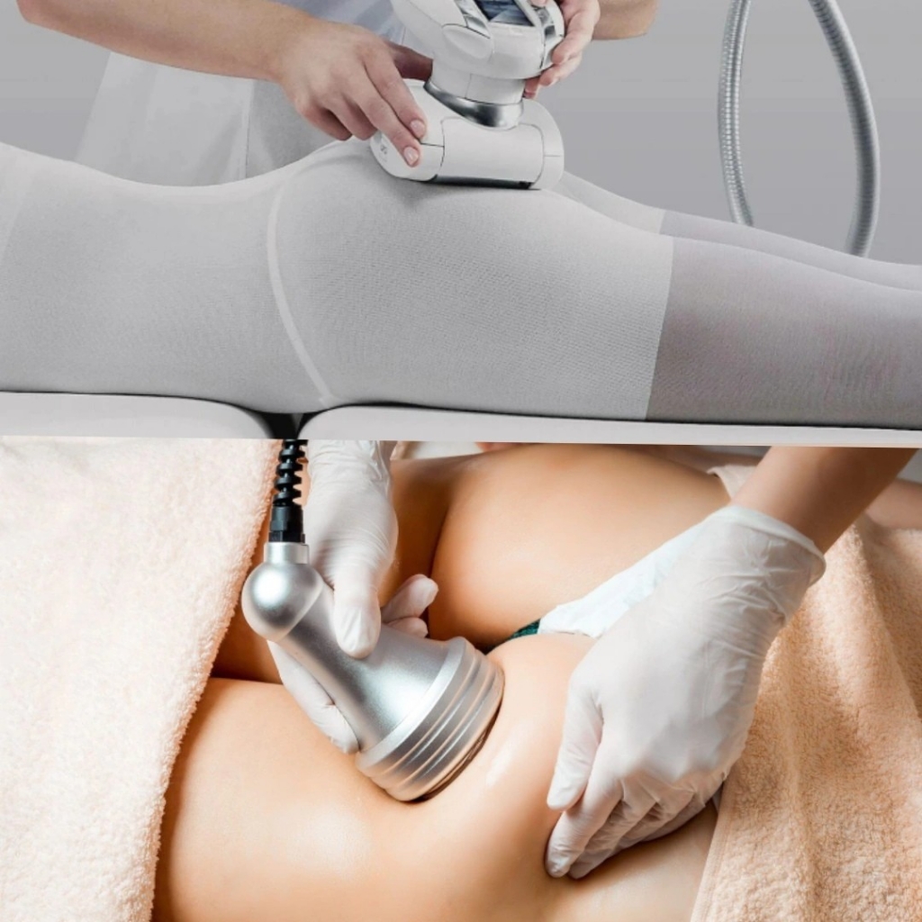 lpg30 +кавитация