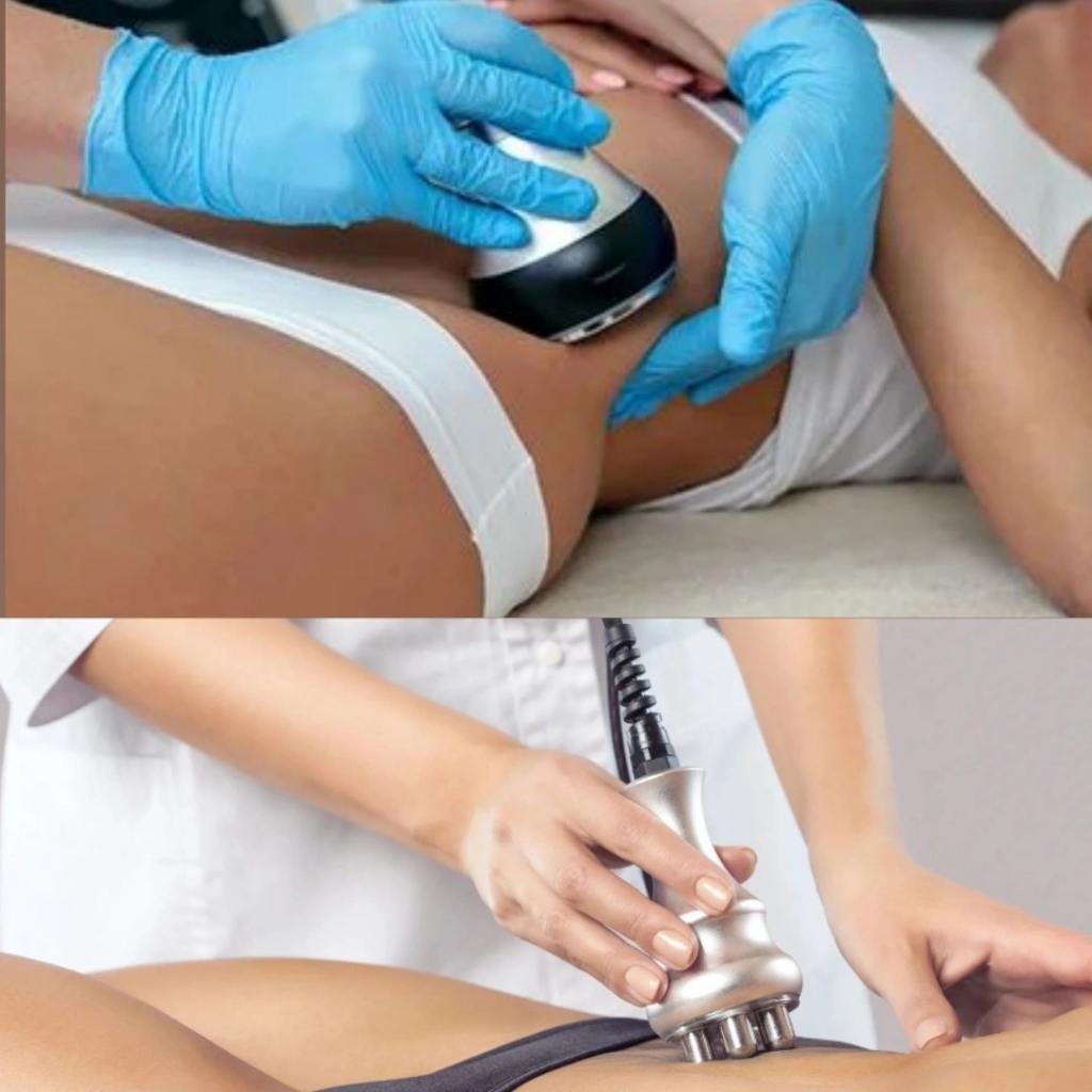 Кавитация+rf