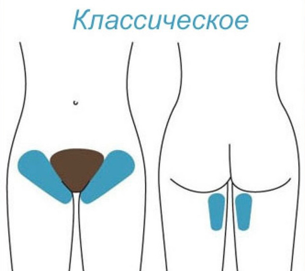 КЛАССИЧЕСКОЕ БИКИНИ