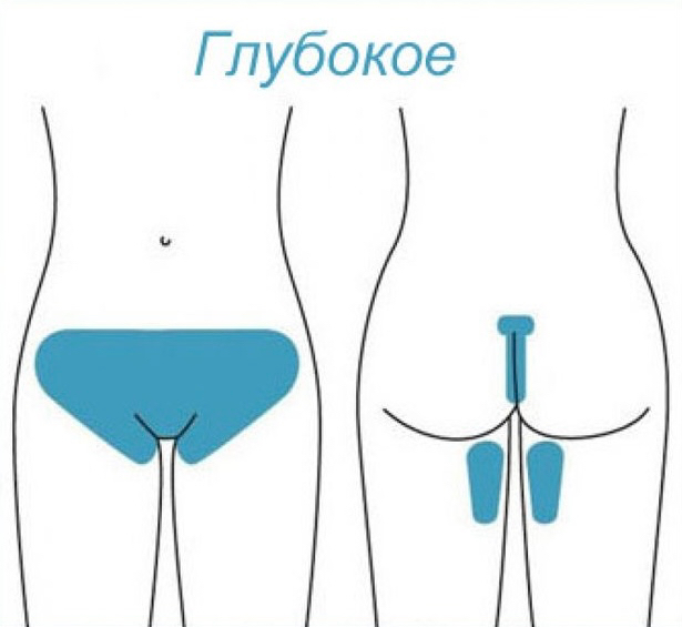 ГЛУБОКОЕ БИКИНИ