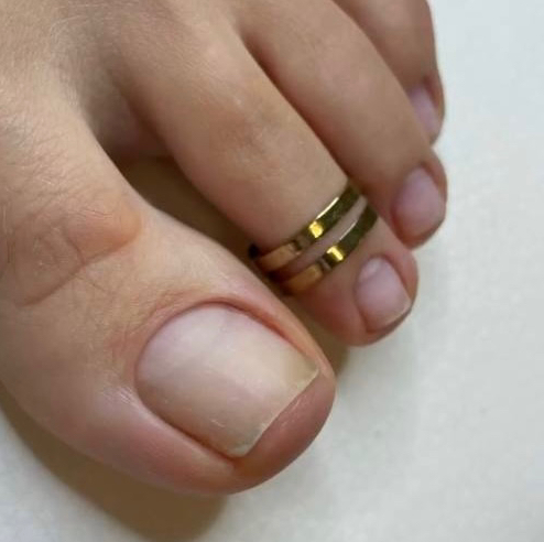 Педикюр SMART гигиена