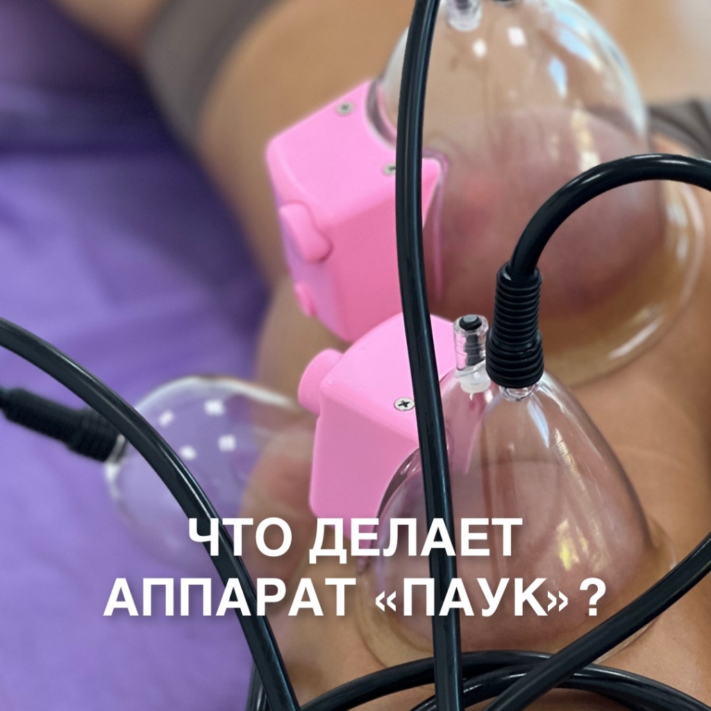 Аппарат Паук