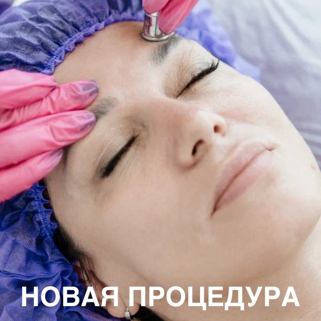 Алмазная шлифовка (пилинг)